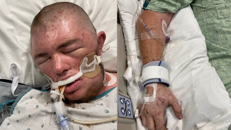 Austin Bellamy permanece en un ventilador en coma inducido médicamente en el Centro Médico de...